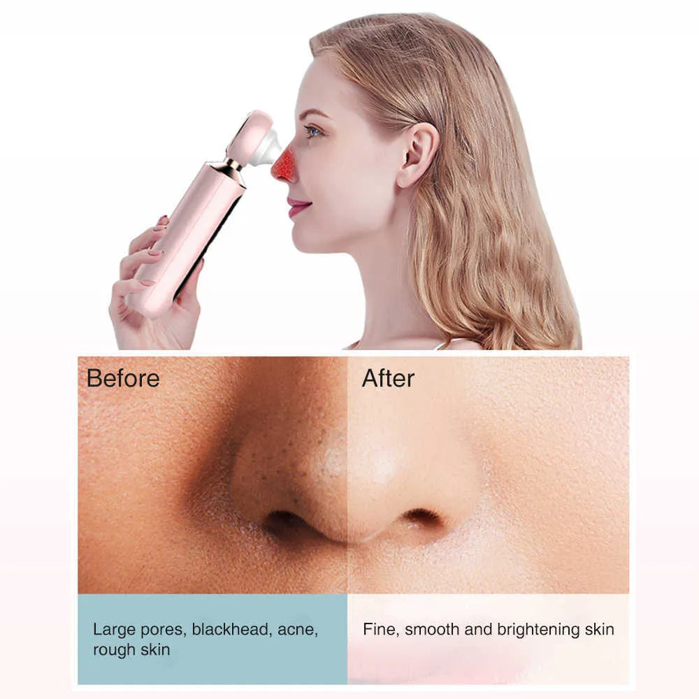 𝙑𝙚𝙧𝙞𝙘𝙘𝙤 𝙒𝙚𝙡𝙡𝙣𝙚𝙨𝙨™ Blackhead Suction Machine