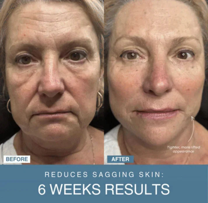𝙑𝙚𝙧𝙞𝙘𝙘𝙤 𝙒𝙚𝙡𝙡𝙣𝙚𝙨𝙨™ 7-in-1 LED Anti-Aging/Wrinkle Apparatus