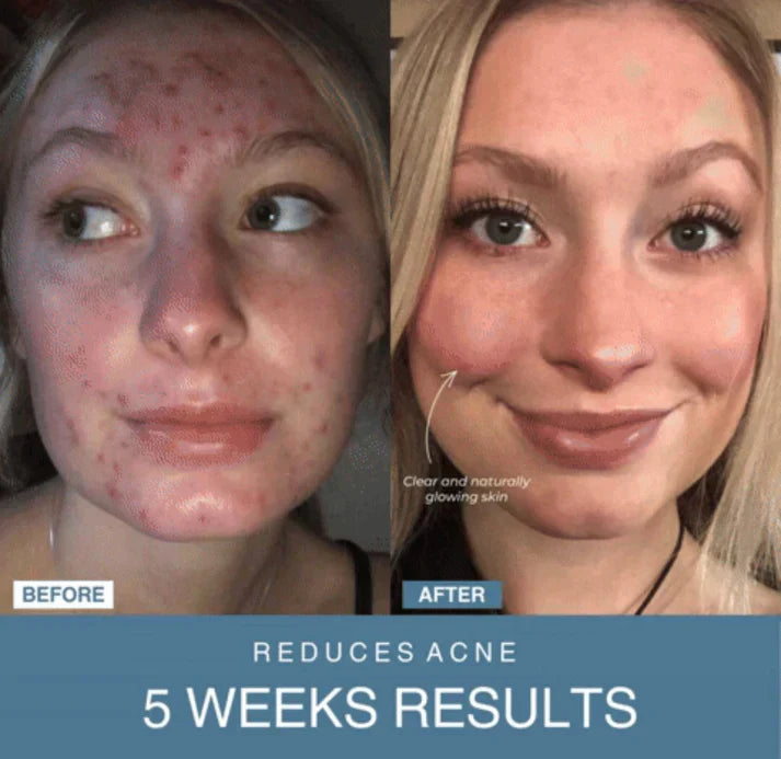 𝙑𝙚𝙧𝙞𝙘𝙘𝙤 𝙒𝙚𝙡𝙡𝙣𝙚𝙨𝙨™ 7-in-1 LED Anti-Aging/Wrinkle Apparatus